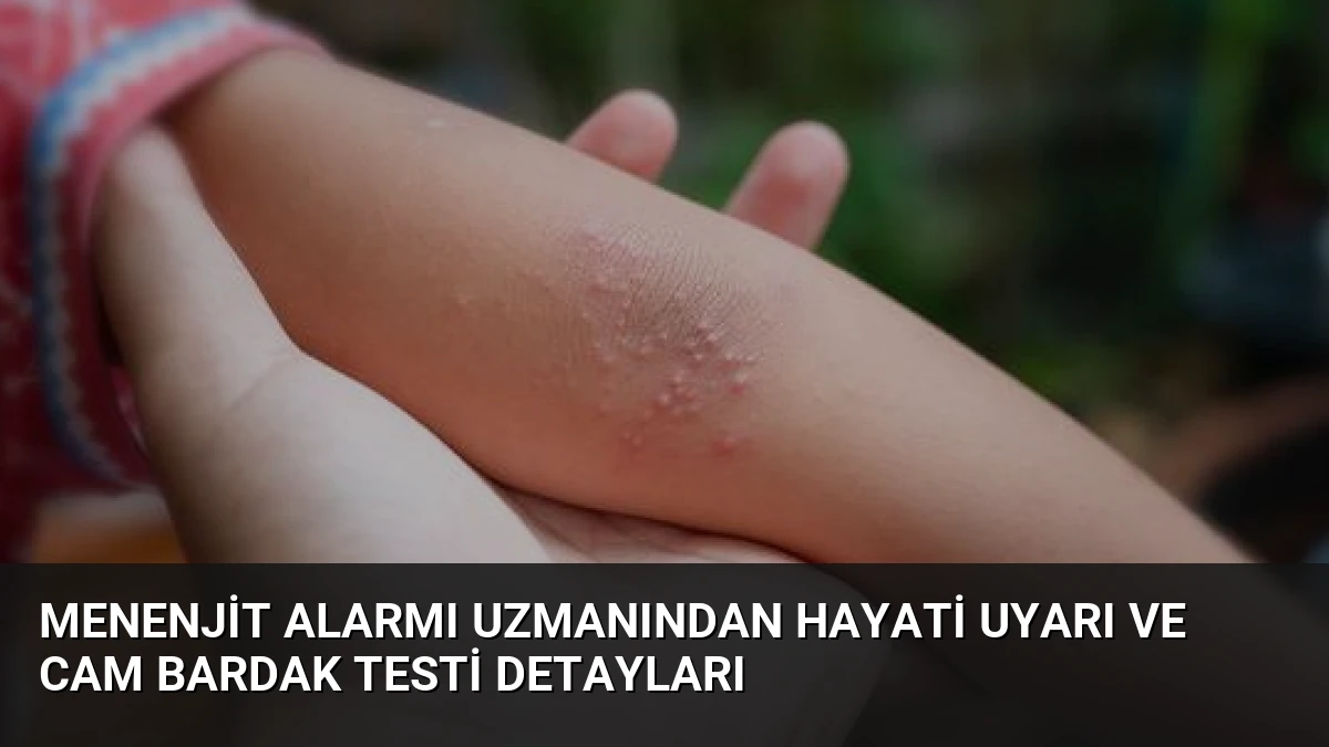 Menenjit Alarmı Uzmanından Hayati Uyarı ve Cam Bardak Testi Detayları