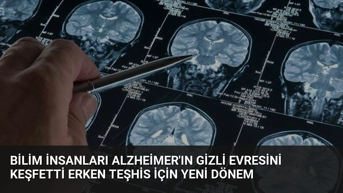 Bilim İnsanları Alzheimer’ın Gizli Evresini Keşfetti Erken Teşhis İçin Yeni Dönem