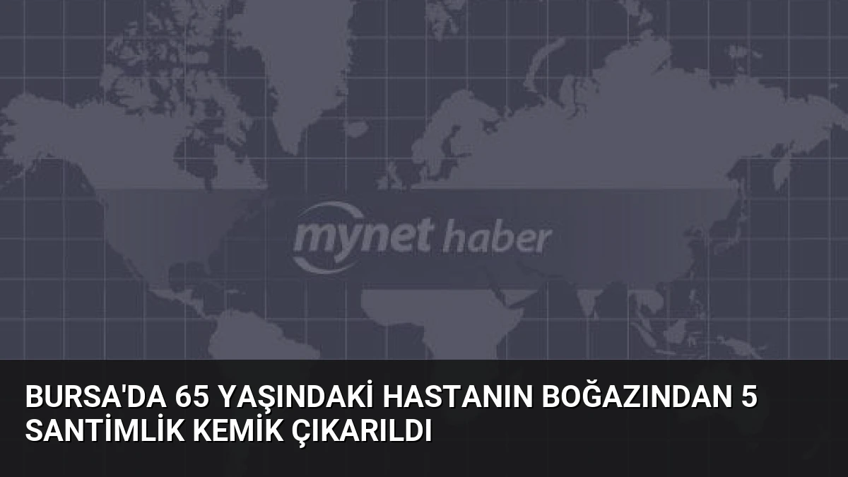 Bursa’da 65 Yaşındaki Hastanın Boğazından 5 Santimlik Kemik Çıkarıldı