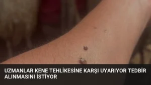 Uzmanlar Kene Tehlikesine Karşı Uyarıyor Tedbir Alınmasını İstiyor